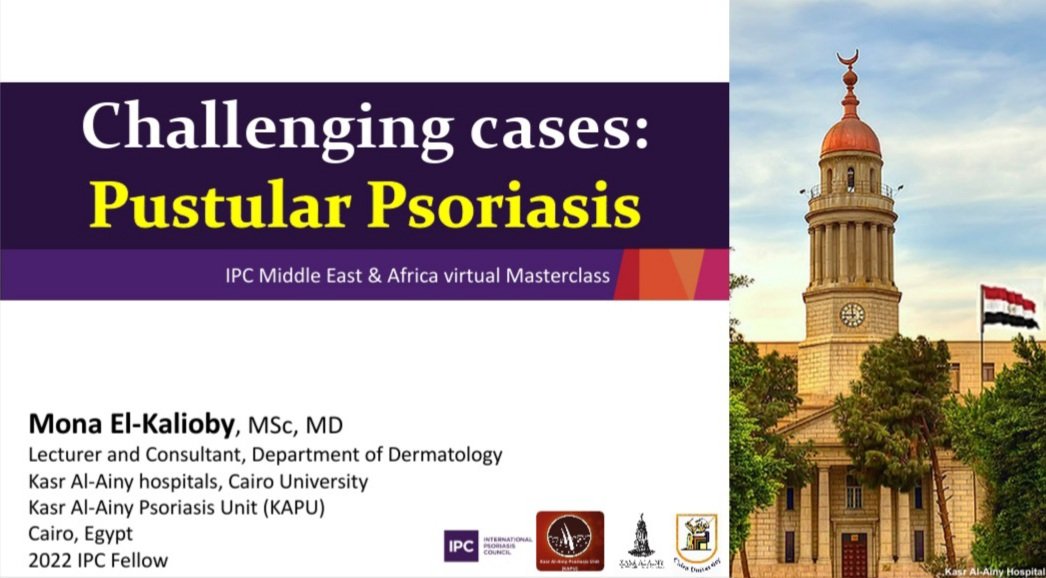 monaelkalioby's tweet photo. It was a great honor &amp; pleasure to present "#PustularPsoriasis challenging cases" in the #IPC Middle East &amp; Africa Masterclass, held virtually today, with an esteemed faculty.
➡️Thrilled to attend the upcoming days of this fantastic class!
Thank you, IPC @IpcPs
#IPCFellow https://t.co/1iUDrNEU2O