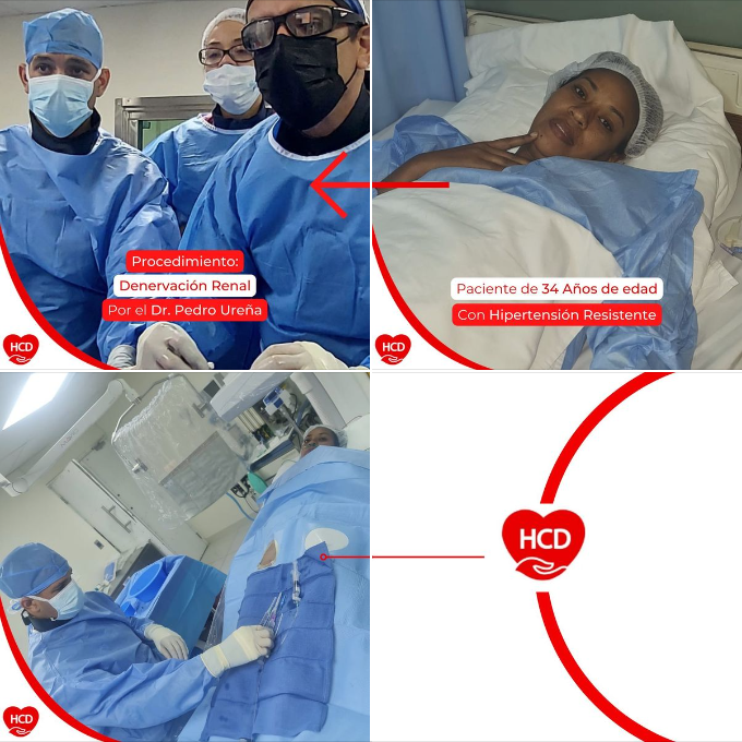 heartcaredom's tweet photo. Denervación renal realizada hoy por el Dr @urenacard. El sistema de denervación renal Symplicity Spyral fue donado por @mercedes_hdez, representantes de Medtronic en el país. 
Gracias a todos nuestros colaboradores y patrocinadores. @saludpublicard @edwardslifesciences https://t.co/FNPUun218h