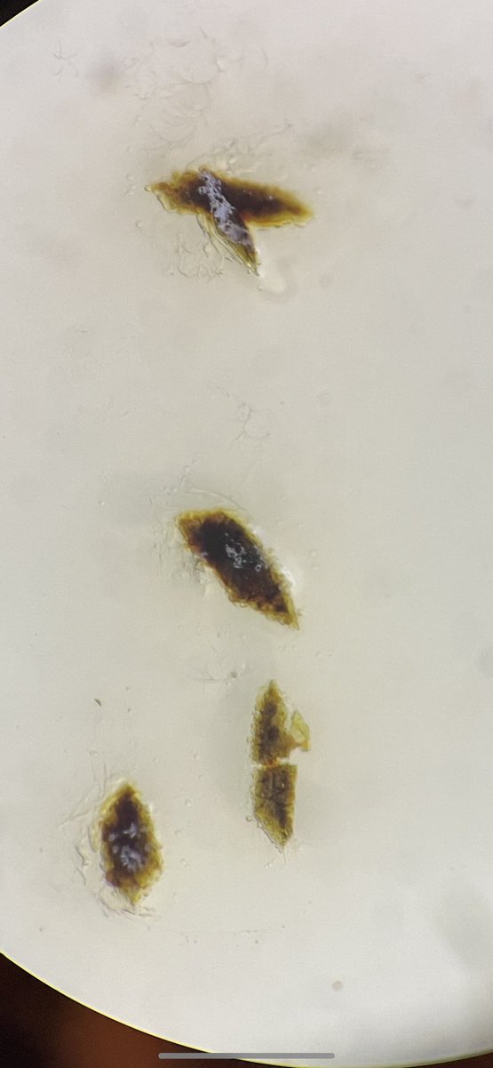 Jsperling91's tweet image. These are the Bk-249 mellitate crystals after 435 days (&amp;gt;t1/2). This is purely radiation damage since the other Ln/An compounds are stable under standard conditions (even an Np(iii) one!) in the first pic each crystal was decaying ~20,000,000 times per second lol #fblockrocks