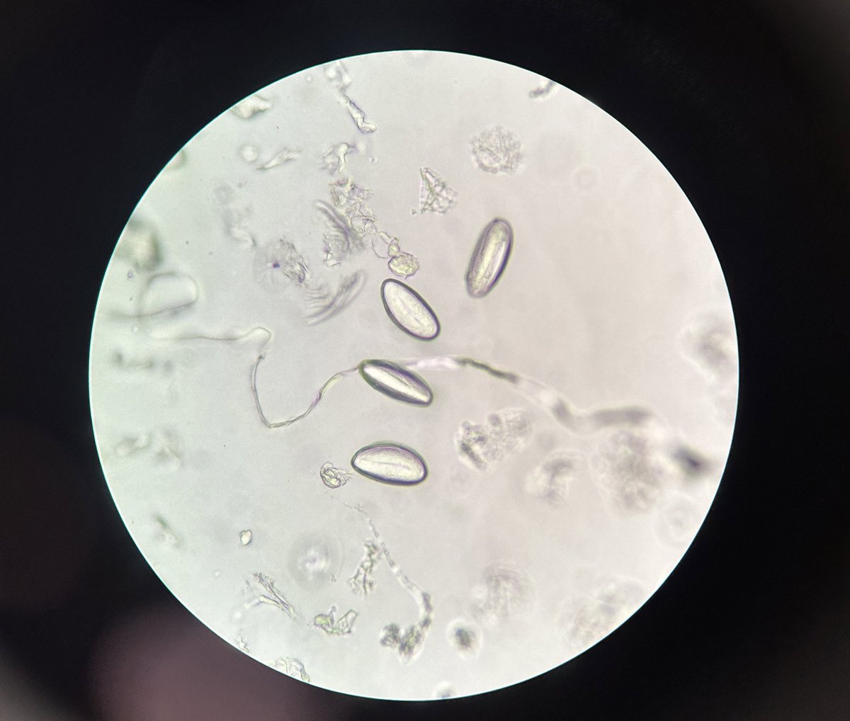 mikrobilim_en's tweet photo. Enterobius vermicularis eggs :) 🥚#enterobius #scicomm https://t.co/le4u7E21Yu