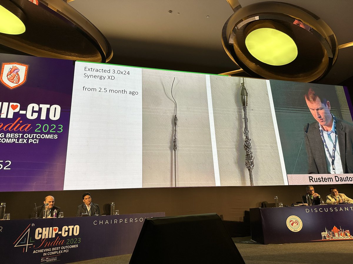 mmamas1973's tweet photo. @dautov_MD #chipcto rotablation through previously deployed LAD stent with stuck burr and stent embolectomy ๐ณ great case- learning point, protect your fresh stent with guide extension when rotablating @Dr_AshokSeth @jcspratt @mirvatalasnag @LAzzaliniMD @NishithChandra https://t.co/lDtDyWqwYg