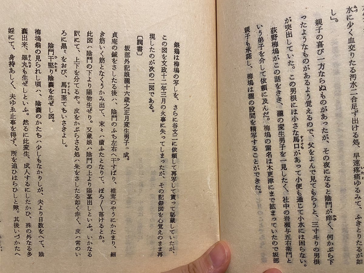 最近読んだ本。花咲一男の『珍説ニ生考』。太平書屋より限定200部で販売された珍本。国会図書館データベースに載ってない。
江戸期に書かれた随筆や日記より娘たちから男根が生じて男性に変じた半陰陽(フタナリ)の記事が抜粋して紹介されている。男根を切除したパターンや男に改名したパターン様々。 