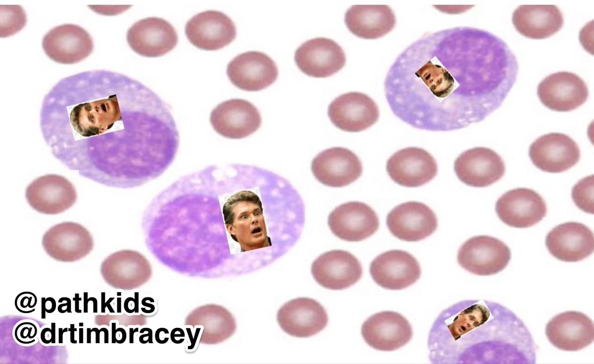 Tim Bracey tweet media