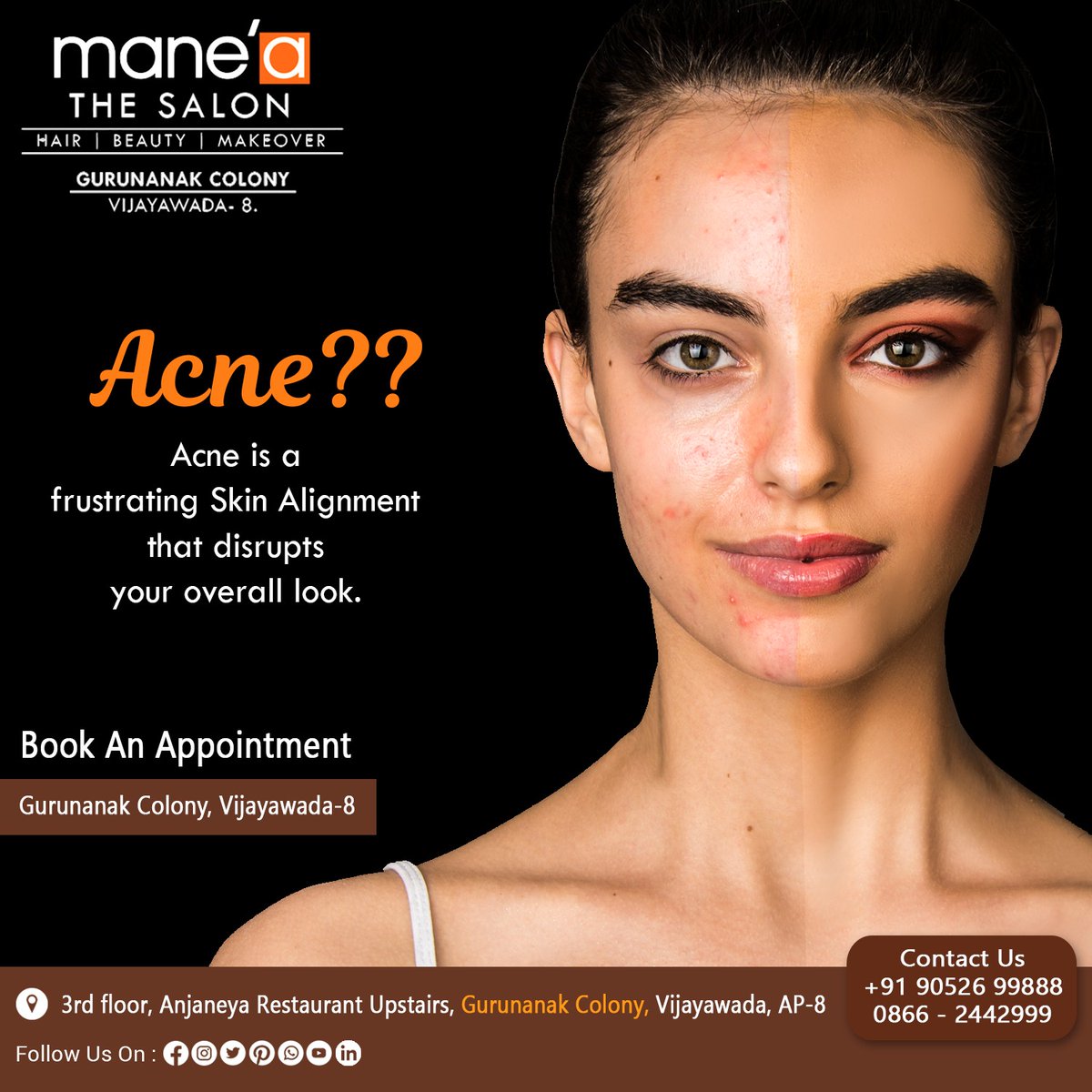 Don't settle with this frustrating acne!
Book appointment now to get rid of this beauty spoiler acne

#manea #maneagurunanakcolony #salon #unisexsalon #acne #acnetreatment #acneproblems #acneremedies #acnesolutions #acnesolutions