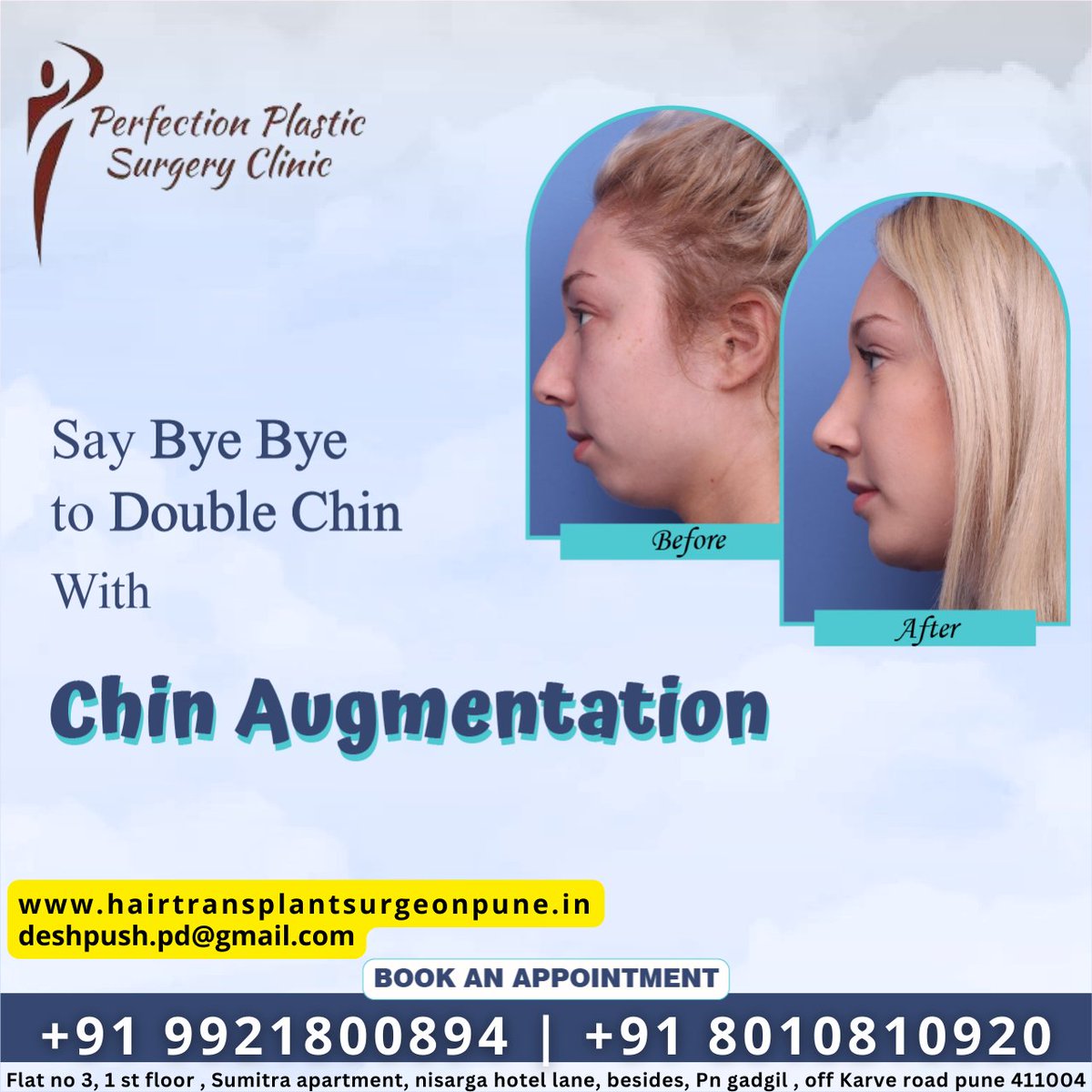 Say bye Bye to double chin with chin augmentation
Make your Smile More Attractive
Book An Appointment

Call : - +91 9921800894

Call : - +91 8010910920

#perfectionplasticsurgeryclinic #face #skin #lips #chinaugmentation