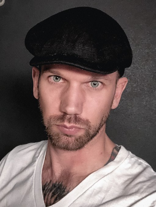 Having my Facial Feminization Surgery in April, and couldn&rsquo;t be more excited! Estradiol + T blockers<a href="/tag/happypridemonth"class="tags"><span>#happypridemonth</span></a><a href="/tag/pridemonth"class="tags"><span>#pridemonth</span></a><a href="/tag/hrt"class="tags"><span>#hrt</span></a>