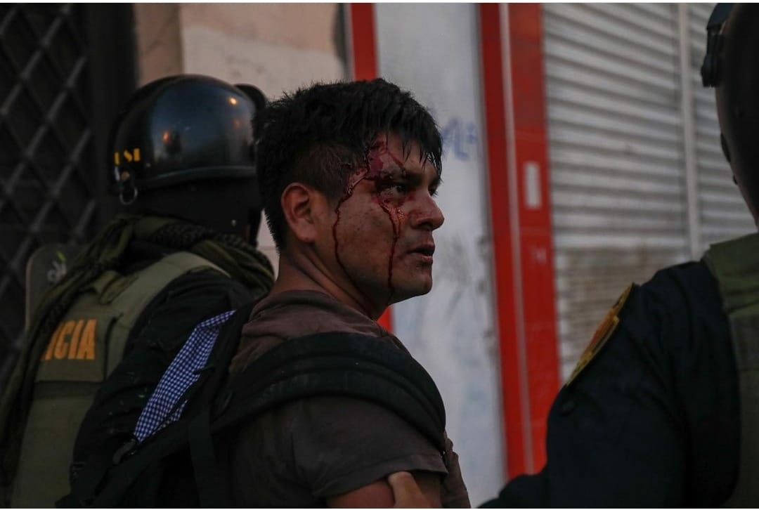 Dante_MoralesT's tweet photo. GRAVE DENUNCIA PÚBLICA
Luis Junior Peña Álvarez, joven egresado sanmarquino de la carrera de Derecho, denuncia que fue intervenido a golpes durante la jornada de protestas del día martes, existiendo pruebas audiovisuales en abundancia de la dura represión que sufrió. (1/7) https://t.co/aV2WJvCHzQ