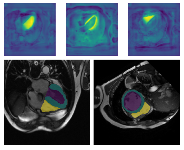 sandro_alex's tweet photo. This is my last post about a comparison between #unet and #segformer with a segmentation task.
#pytorch #deeplearning #machinelearning
https://t.co/u3faAkJB7j https://t.co/y5qQj7beh6