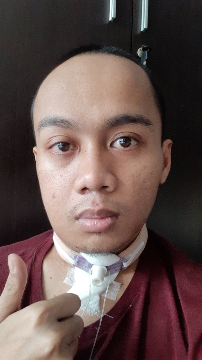 anwaarzz's tweet photo. Kembali botak https://t.co/Owbpu1HKmS