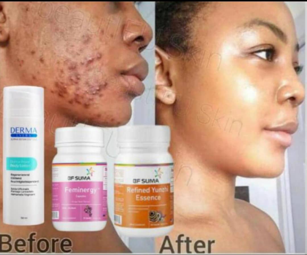 ArihoDr's tweet photo. @CleviaAtwine Skin care products, 0709218588/0780368149 https://t.co/nN82Rj1Zog