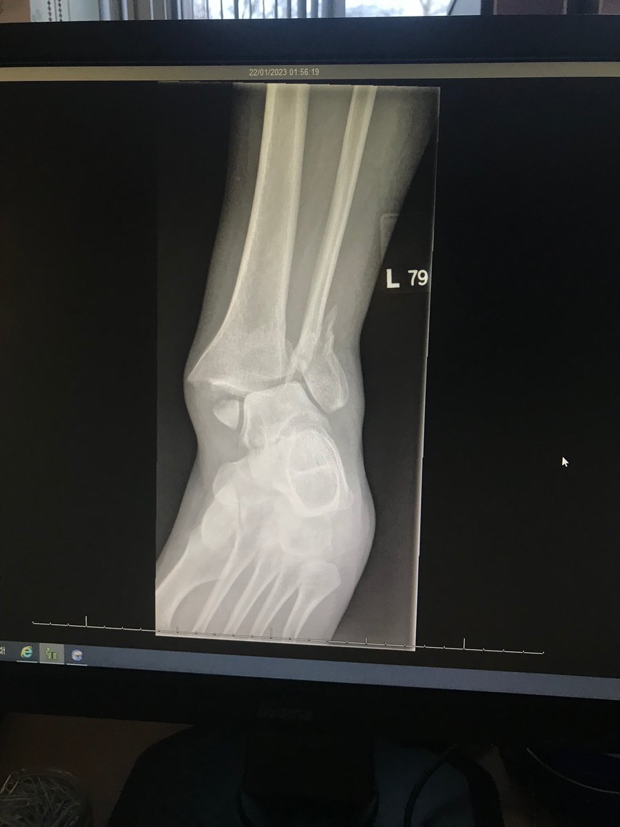 Davers73's tweet photo. Life has been extremely hectic for the last few years and for a long time I’ve felt like I needed a decent break.

However, this wasn’t quite the break I was hoping for. https://t.co/wqHQuO6ERo