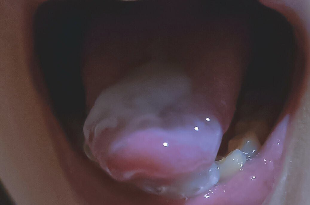 Ccen1234's tweet photo. 上当了，这弟弟说最近吃了很多水果蔬菜，味道是甜的😭😭#合肥 https://t.co/HzxxbgxG6U