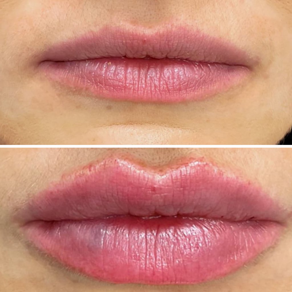 MD_Spa's tweet image. Contact us today:
Call: (780)9299797
Text: (780)9349021
DM: @MDSPALASER
Email: beaumont@mdspa.ca
Web: mdspa.ca

#edmonton #yeg #yeglocal #yegbusiness #alberta