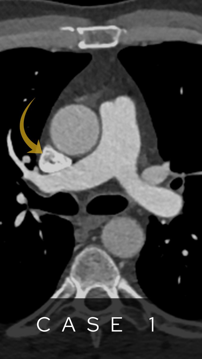 theRadiologist on Twitter "Radiology anatomy quiz Answers below…"