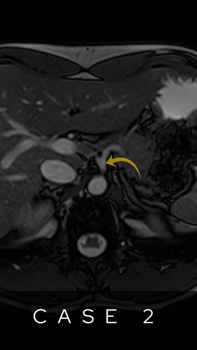 theRadiologist on Twitter "Radiology anatomy quiz Answers below…"