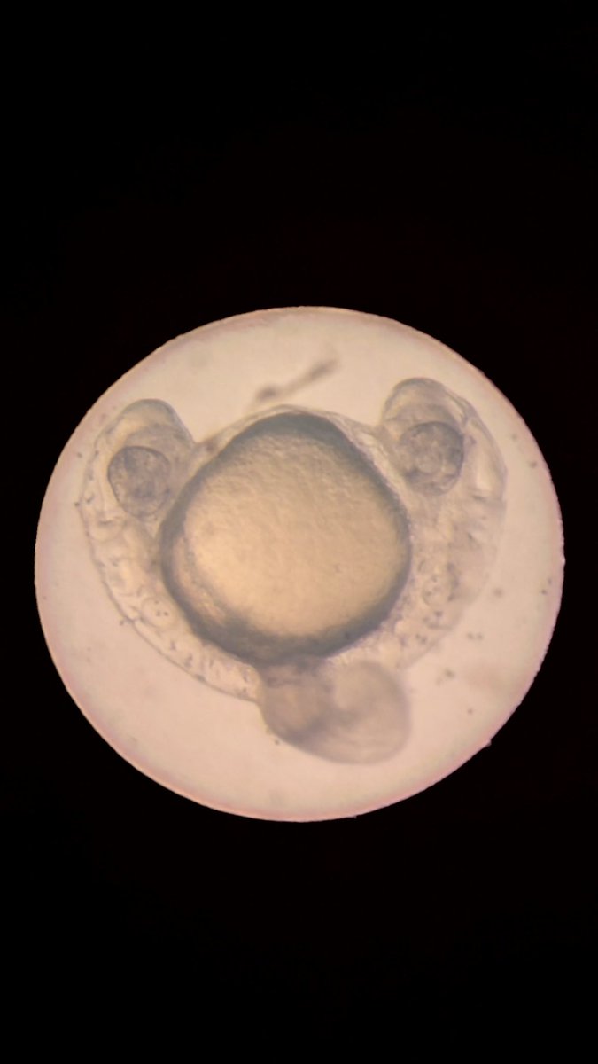 DGulensoy's tweet image. Today I had a fascinating surprise in my cross. Say hi to my conjoined zebrafish embryo 😍