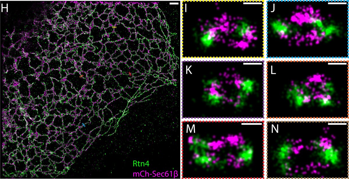 Bewersdorf Lab (@bewersdorflab) on Twitter photo Our latest work is a #bioRxiv double feature: Endoplasmic reticulum tubules are ellipsoidal thanks to the nanoscale organization of Rtn4 oligomers (biorxiv.org/content/10.110……)! Lukas Fuentes <a href="/zacsimile/">Zach Marin</a> <a href="/jtysonphd/">Jonathan Tyson, Ph.D.</a> <a href="/DavidBaddeley5/">David Baddeley</a> <a href="/YaleCellBio/">Yale Cell Biology</a> #er #ellipsoidaler and... Our latest work is a #bioRxiv double feature: Endoplasmic reticulum tubules are ellipsoidal thanks to the nanoscale organization of Rtn4 oligomers (biorxiv.org/content/10.110……)! Lukas Fuentes <a href="/zacsimile/">Zach Marin</a> <a href="/jtysonphd/">Jonathan Tyson, Ph.D.</a> <a href="/DavidBaddeley5/">David Baddeley</a> <a href="/YaleCellBio/">Yale Cell Biology</a> #er #ellipsoidaler and...