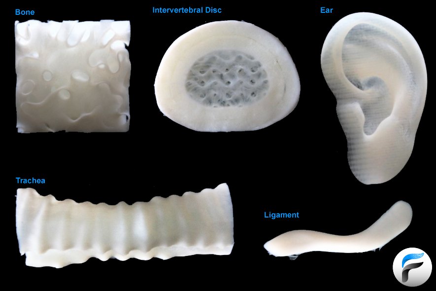 DoctorDeTejidos's tweet photo. Esta tecnología ya ha sido utilizada para crear:
🔷 Piel humana funcional
🔷 Cartílago
🔷 Vasos sanguíneos
Actualmente se intenta generar órganos, lo cual podría reducir la necesidad de donantes de órganos
#organreplacement
🧵
2/3 https://t.co/6HAhq04tXT