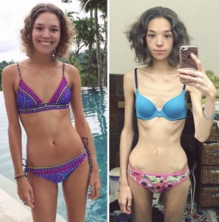 urm0mkcals's tweet image. THIS PICTURE TRIGGERS ME SO BAD FUCK