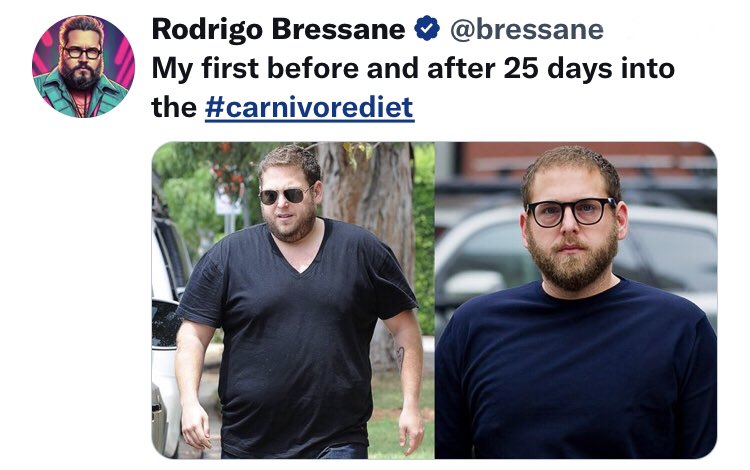 LowCarbHealthMD's tweet image. The POWER of ZERO CARB 👍🏼

CARNIVORE DIET = ZERO CARB.
The LEAST insulinogenic. Ever.

#LCHF #KetoPower #LowCarb #Ketogenic