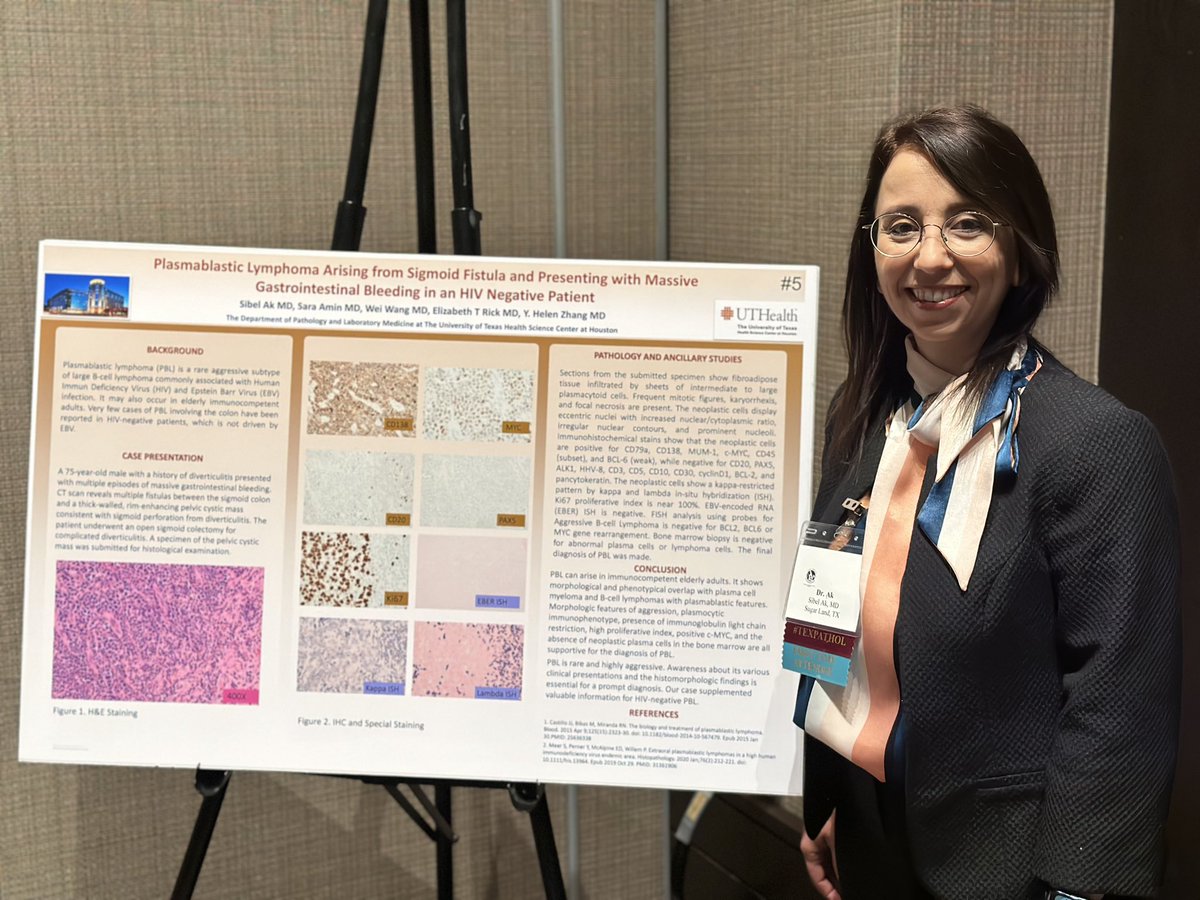 SibelAk_MD's tweet image. Grateful to represent UTHealth Houston Pathology with my poster presentation  @TexPathol in Plano, Texas. 
Thank you @HelenZhangMD1 for this opportunity and your mentorship!
#TSP2023AM 
#PathTwitter