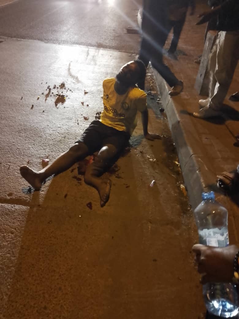 Gery_Gerrald's tweet photo. As I'm turning 27 today, haya ndiyo niliyoyapitia tokea tarehe 23.10.2022 mpaka leo, lakini mimi ni nani nisiseme "ASANTE MUNGU" kwa kunipa uzima mpaka Leo..

NB: PICHA ZINATISHA KIDOGO.

Ni hivi, usiku baada ya derby ya Simba v/ Yanga nilikua narudi nyumbani, kufika maeneo ya 👇🏿 https://t.co/ewU38k2cpd