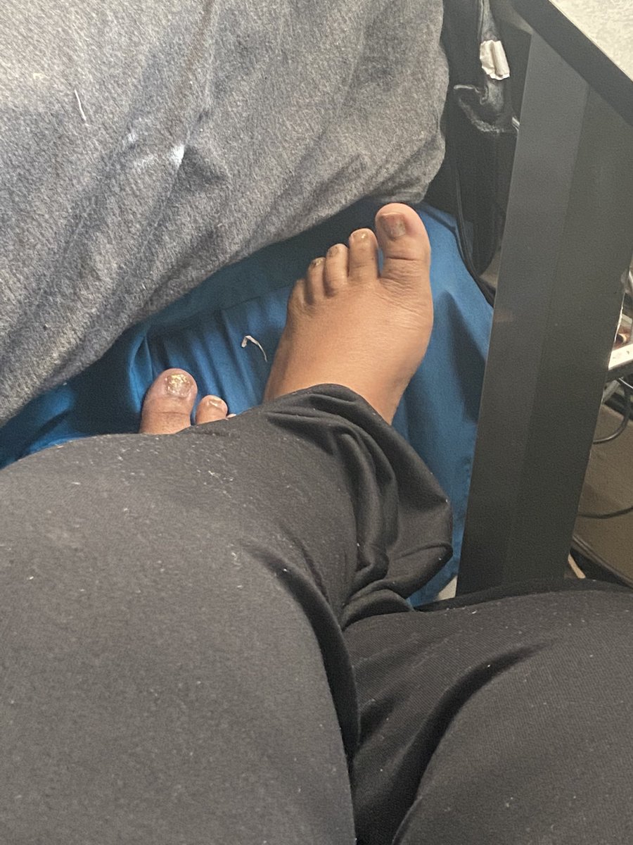 sowetnwarm's tweet photo. I’ve been on my feet too long #worship #feet https://t.co/Rw7fgRVtO0