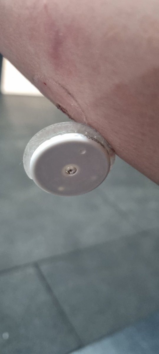 emmabevann's tweet photo. A diabetic's worst nightmare 😬 perils of weight training.... seems ill be flying blind for the rest of this session #type1diabetes #freestylelibre #ouch #GBDoc https://t.co/aNvbUMvExi