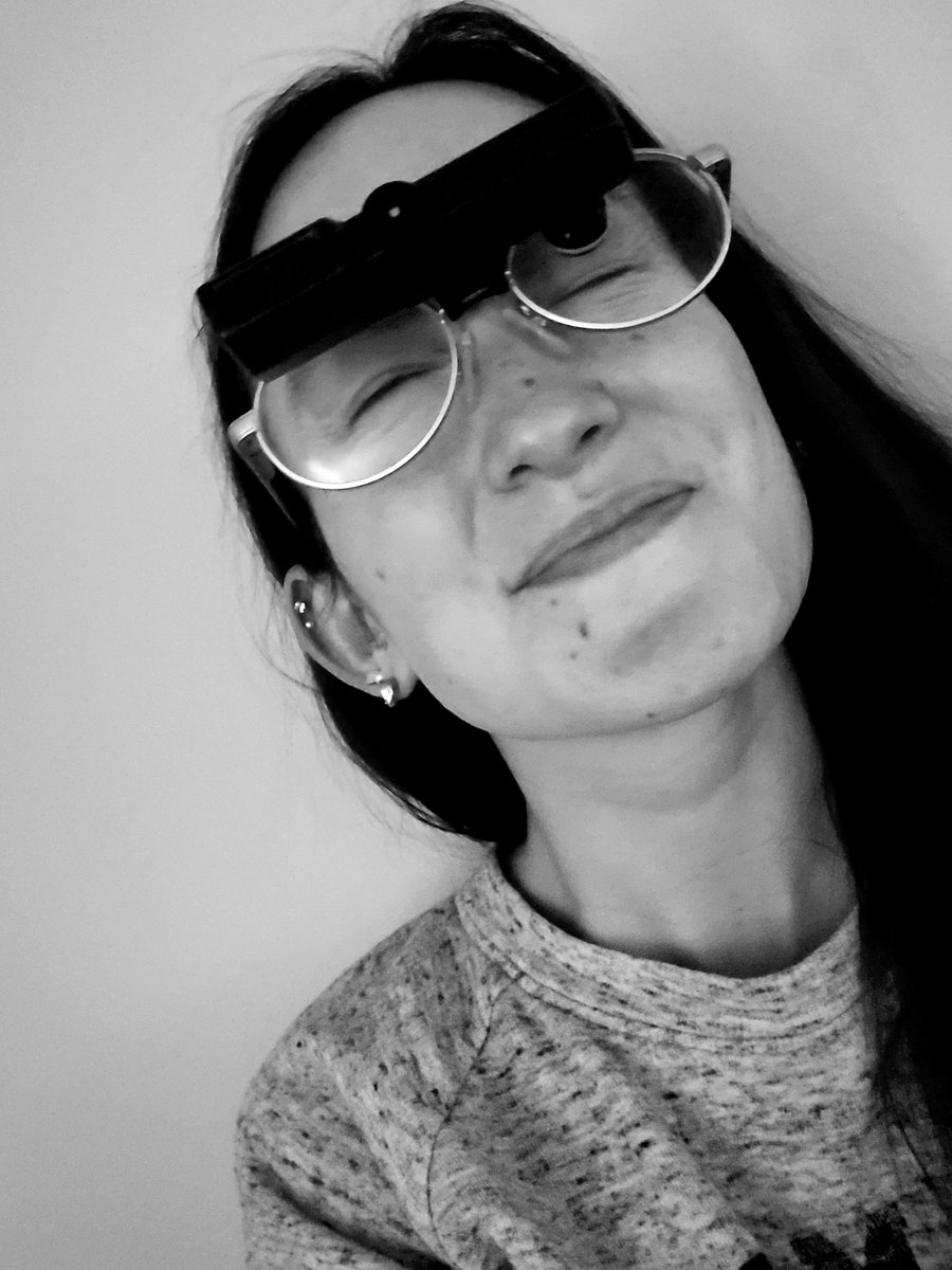 Ashli_Bananas's tweet photo. 11 years ago I was diagnosed with Stargardts which causes me to slowly lose my vision. Last year I truly embraced being low vision and challenged myself more than ever. These are my Bioptics, they allow me to continue driving and keep my independence❤️ #lowvisionlife #thisisme https://t.co/aYkSJCZKOW