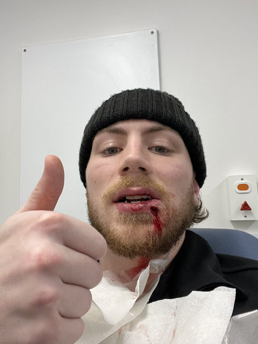 Thank you <a href="/Mcr_Storm/">Manchester Storm | #TakeShelter</a> fans for all the messages! All is good ❤️ grateful for everyone’s support⛈️ Soup and Smoothies for the next bit 😂