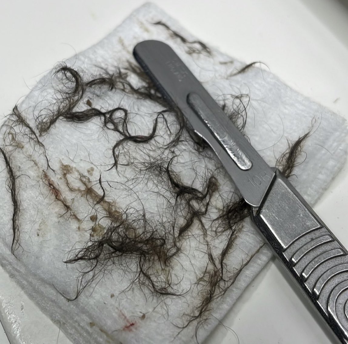 GLOSKINLAB's tweet image. dirt, oil, and vellus hair build up after a good dermaplane + extractions session. ✨