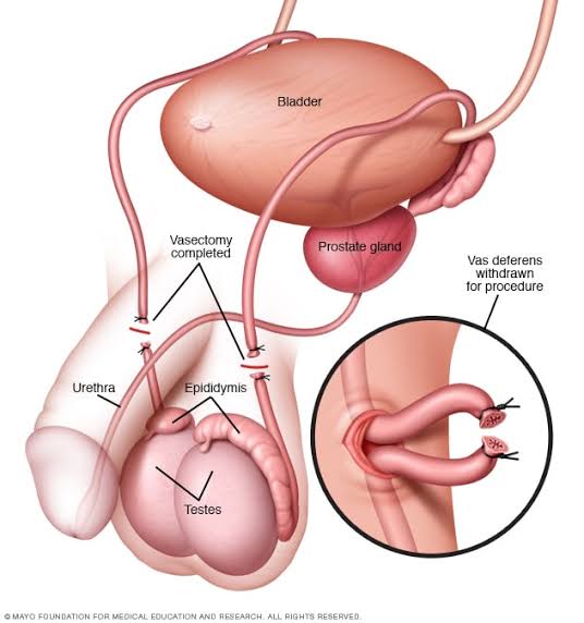 GatwaElijah's tweet photo. Deut 23:1 'No one whose testicles are crushed or whose male organ is cut off shall enter the assembly of the Lord' Men, let's say NO to #VasectomyExplained @ntvkenya https://t.co/dZTz4zpViP