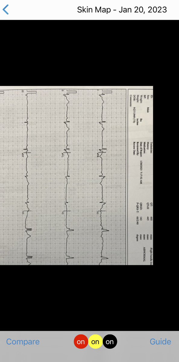 Carrying a baseline EKG for quick comparison on your smartphone app makes a lot of sense. Additionally, baseline pictures of moles can save unnecessary biopsies &amp; assist with detecting change.