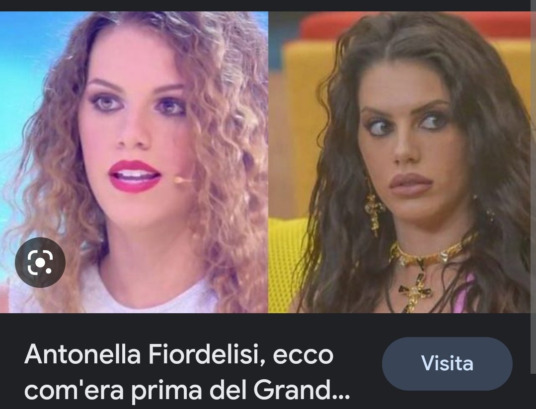 Lulurossonera's tweet photo. Qui vediamo #Oriana che pensa solo all'estetica 😱
Ah no 😂😂😂😂
No ma ho fatto solo una volta tanto tempo un filler alle labbra 😂😂😂😂😂😂😂
Ah ok
#bugiardella #rifattella
#gfvip #tontonella #vittimella
#Oriana #onestini #tavassi https://t.co/FiOt64Mzvy