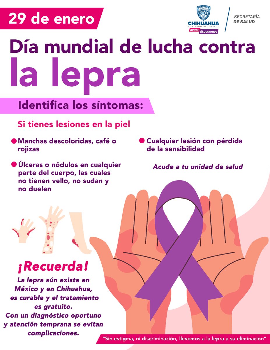 En el #DíaMundialdeLuchacontralaLepra recordamos que mediante el diagnóstico oportuno de los síntomas de este padecimiento, se brinda el tratamiento gratuito, y con ello se evitan complicaciones.
Acude a tu unidad de salud para una atención temprana. 👈
#JuntosSíPodemos