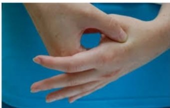 RudiyanaAbie's tweet photo. Bismillaah....
Biasa disebut titik Hegu (titik nyeri),
"tombol ajaib" untuk meredakan sakit kepala, sakit gigi dan sakit2 lain yg sering datang tiba2 (akut).
Bisa dgn jarum akupunktur atau pijatan (berulang², sesekali ditahan) atau bs dgn meletakkan batu es pd titik ini)

@axdwin https://t.co/eIK3Io4gwG