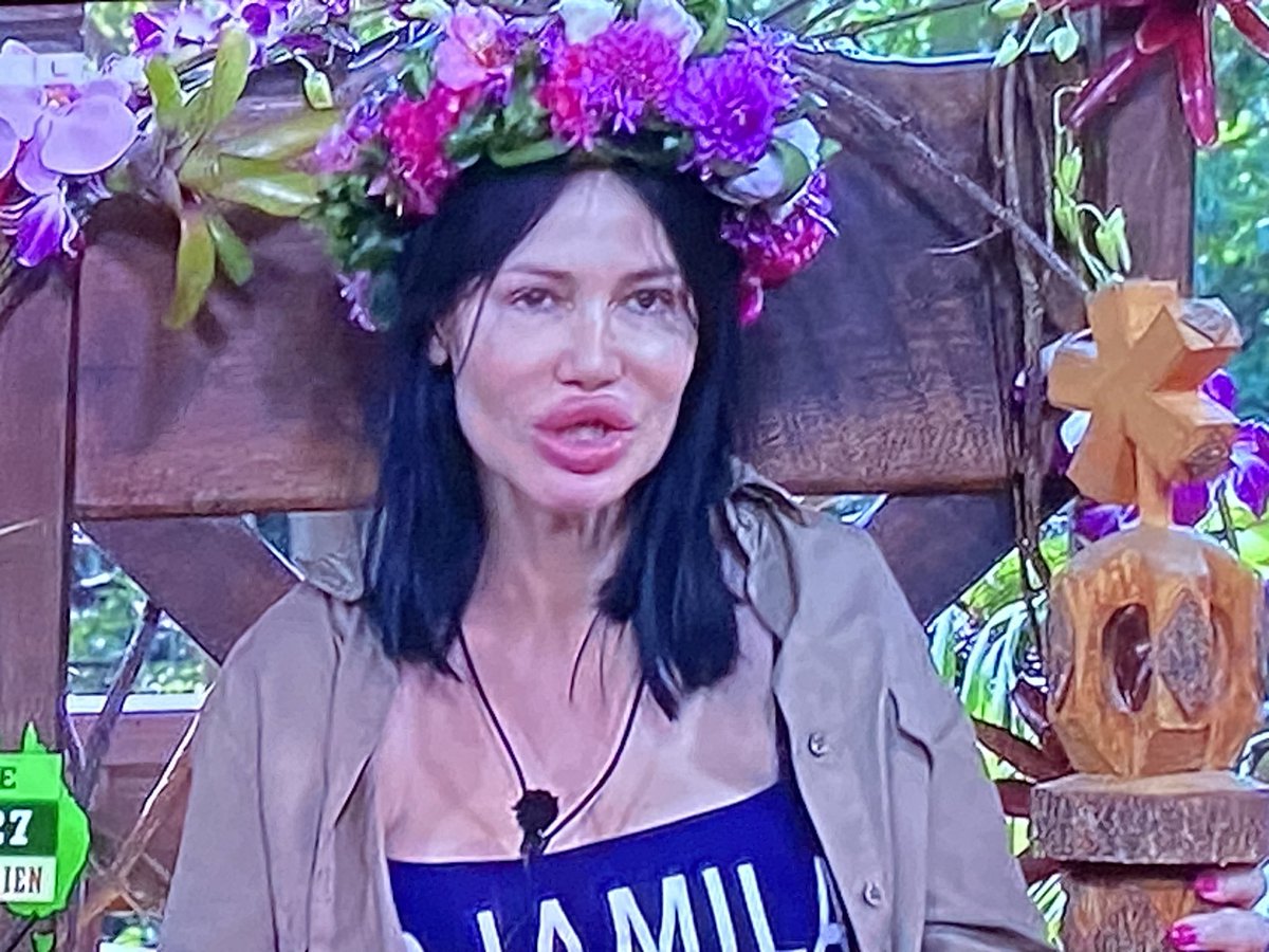 Alles wird gut! ❤️🥹

#ibes #ibes23 #kraftklub #dschungelcamp #rtl