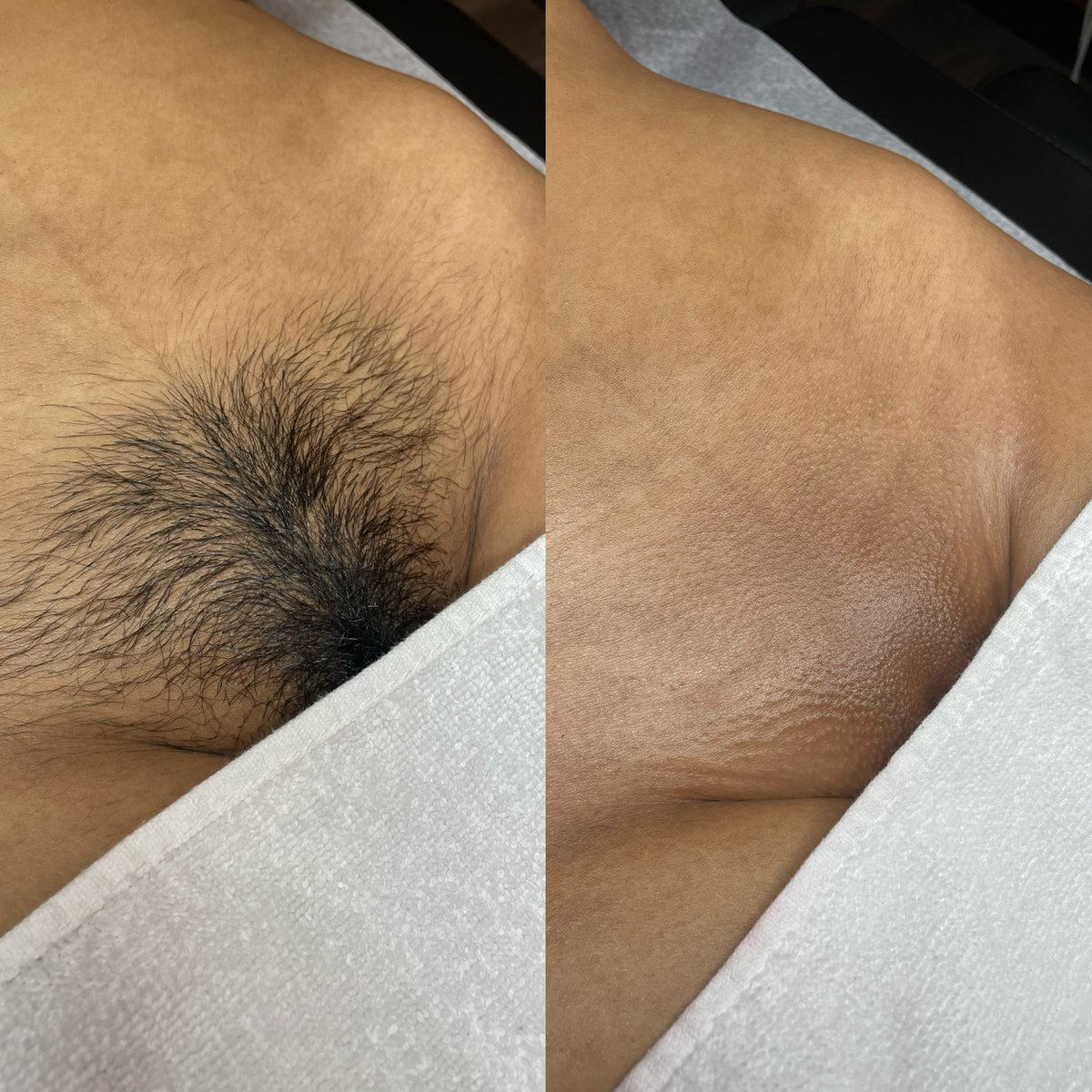 GLOSKINLAB's tweet image. babydoll wax 🍒🍒🍒