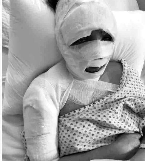 AlessandraRdlv's tweet photo. Empezamos la lucha contra los ataques con ÁCIDO hace casi CINCO años. Sin descanso.

Annie @AnaHSaag fue atacada al llegar a su casa en CDMX. Sus agresores siguen libres, la FISCALÍA nos ha fallado y traicionado, vendieron información confidencial y hoy hay más víctimas.

🧵👇🏽 https://t.co/fSIqhpLBUc
