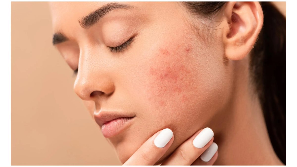 Say goodbye to brown spots on your skin with the right skincare routine and products.
#BrownSpotRemoval #ClearerSkin #FlawlessComplexion
#SkinBrightening #BeautyTips #SkincareGoals #DermatologistAdvice #SpotlessSkin #Womensframe