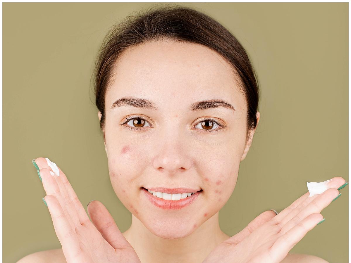 It's important to protect your skin from further sun damage by using sunscreen and wearing protective clothing to prevent new brown spots from forming.
#SpotlessSkin #DermatologistAdvice #SkincareGoals
#BeautyTips #SkinBrightening #FlawlessComplexion
#ClearerSkin #Womensframe