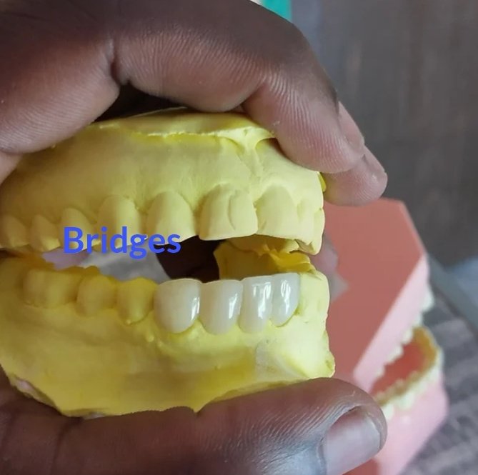 omara_AlbertM's tweet photo. At @TorachDentist Gulu City, we understand that each person's smile is unique &amp; we offer dental services in a relaxed environment. #Uganda #dentistry #أكره_النقاب 🇺🇬 🦷 https://t.co/HxoSScvZID