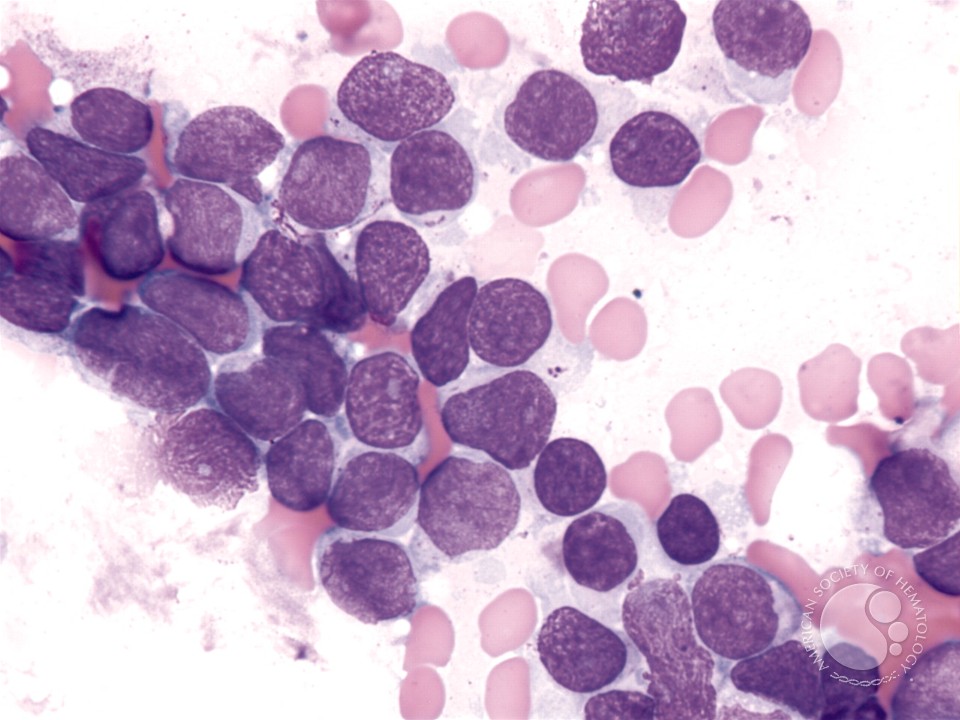 jhmr_journal's tweet photo. NUS scientists breathe new life into an existing drug to fight T-cell acute lymphoblastic leukemia
https://t.co/NF7uXVFmjg
#Health #Medical #Reseach 
@GutMicrobiotaWW @MoHFW_INDIA @Healthjournals @HealthJournalW8 https://t.co/4cyG6dbNd8