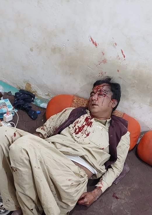 میں جعفرآباد بلوچستان کا صحافی ہوں مجھ پہ قاتلانہ حملہ ہوا مرتے مرتے بچا پولیس ملزمان کو گرفتار نہیں کر رہی، میرے لئے آواز بلند کریں
<a href="/asmashirazi/">Asma Shirazi</a> 
<a href="/HamidMirPAK/">Hamid Mir حامد میر</a> <a href="/javeednusrat/">Nusrat Javeed</a> 
<a href="/WusatUllahKhan/">Wusat Ullah Khan</a>