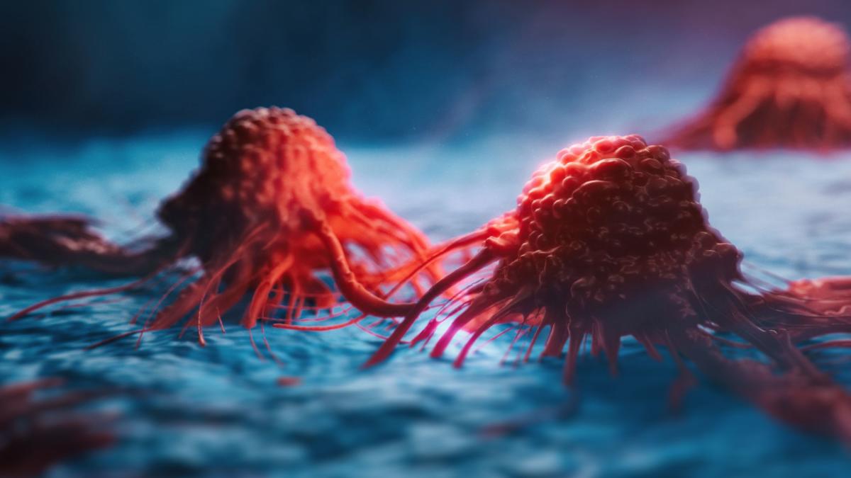 New research hints at why some cancer cells develop drug resistance, and how to kill them. 

#CancerCells #CancerResearch #CellBiology #Chemotherapy #Medicine #DrugResistance 

livescience.com/understanding-… via @LiveScience