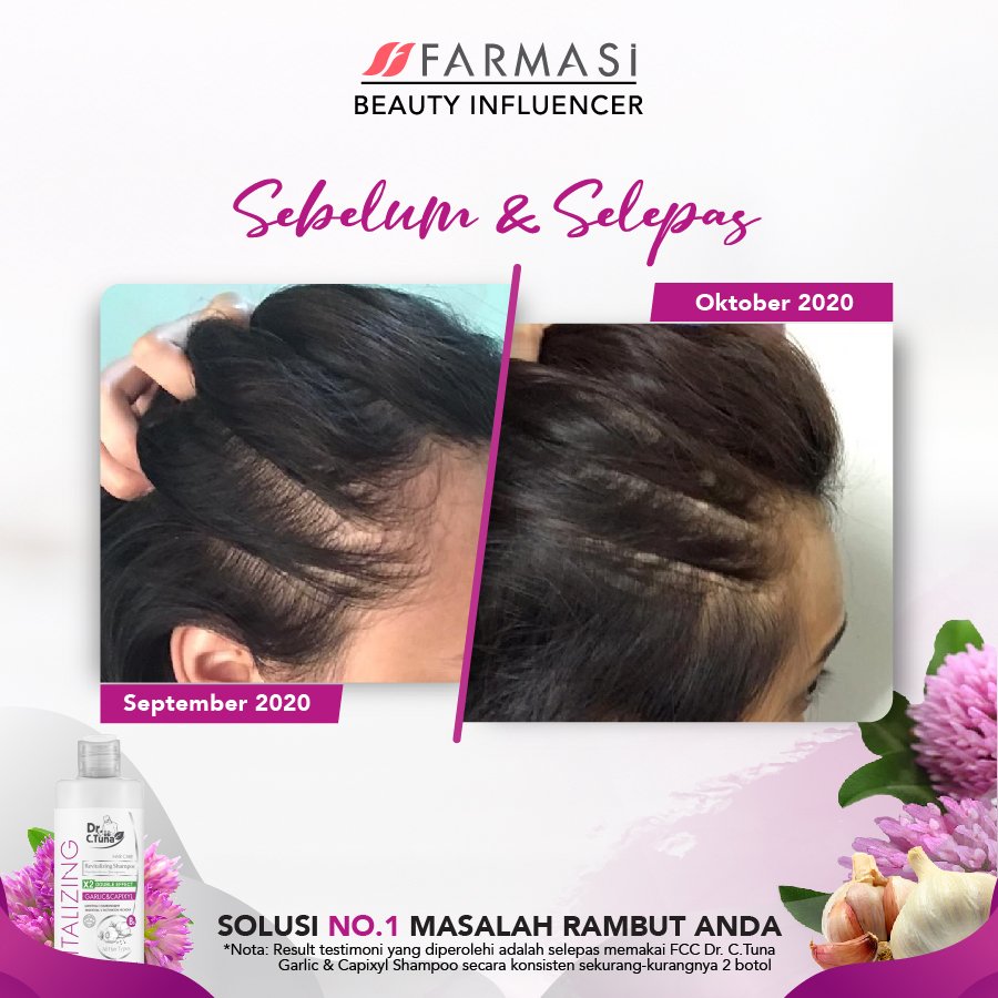 AddarLiz's tweet photo. Ada masalah rambut? Jom cuba Farmasi Vitalizing Garlic &amp; Capixyl 😍. 

Ada promo gila gila tau cepat sebelum habis 😍😍. https://t.co/wHSXiNIa7K

#farmasiproduct #produkfarmasi #baranganmakeup  #syampoountukrambutgugur
#rawatrambutgugur #farmasisyampoo #farmasimalaysia https://t.co/UAbpgP9PRk