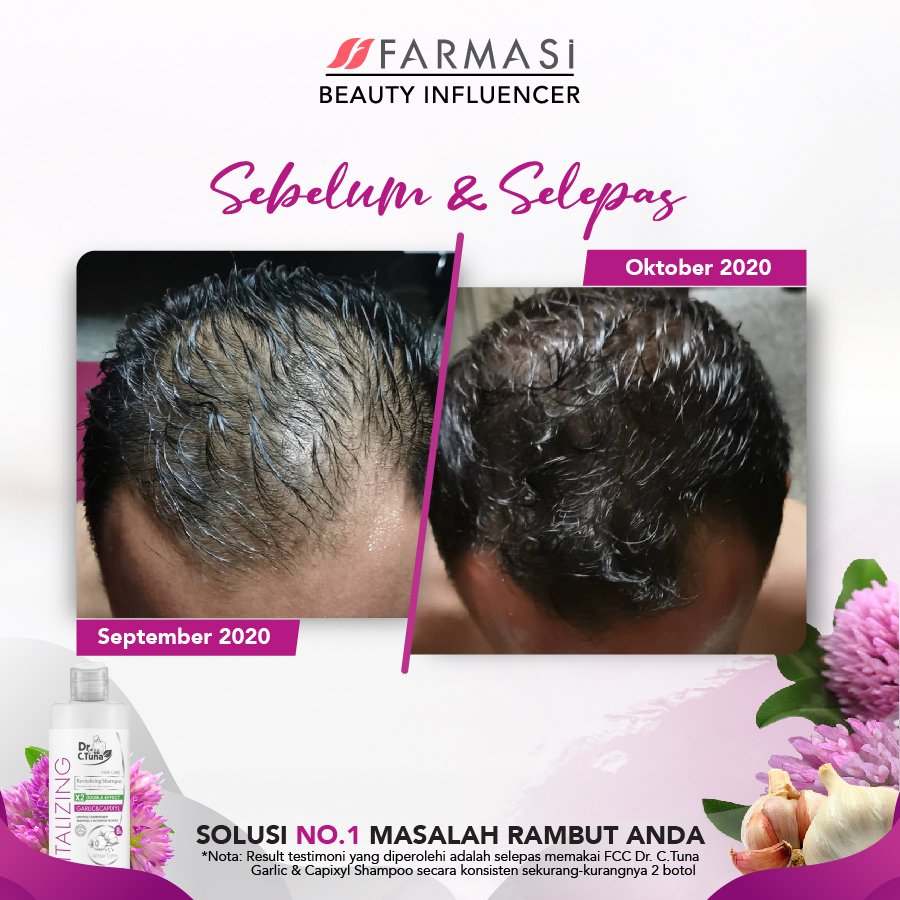 AddarLiz's tweet photo. Ada masalah rambut? Jom cuba Farmasi Vitalizing Garlic &amp; Capixyl 😍. 

Ada promo gila gila tau cepat sebelum habis 😍😍. https://t.co/wHSXiNIa7K

#farmasiproduct #produkfarmasi #baranganmakeup  #syampoountukrambutgugur
#rawatrambutgugur #farmasisyampoo #farmasimalaysia https://t.co/UAbpgP9PRk