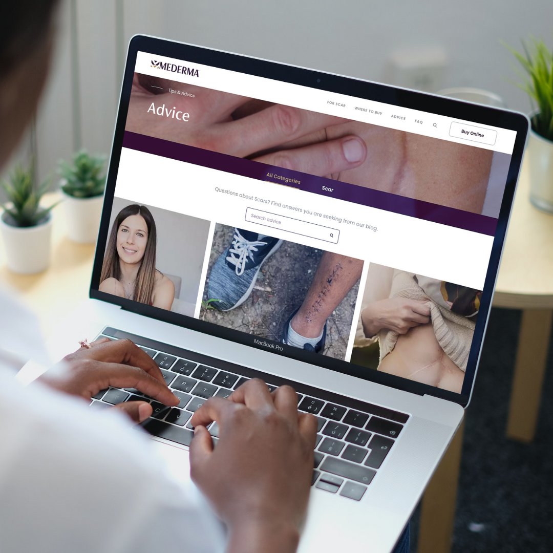 MedermaUK's tweet photo. We're delighted to have expanded our offering on https://t.co/Alx83XAlTh with a new 'scar advice' section featuring 10 articles covering everything you need to know about scar care.

Click the link to check them out - https://t.co/QKgZwFrasK https://t.co/xarXe2HdrI