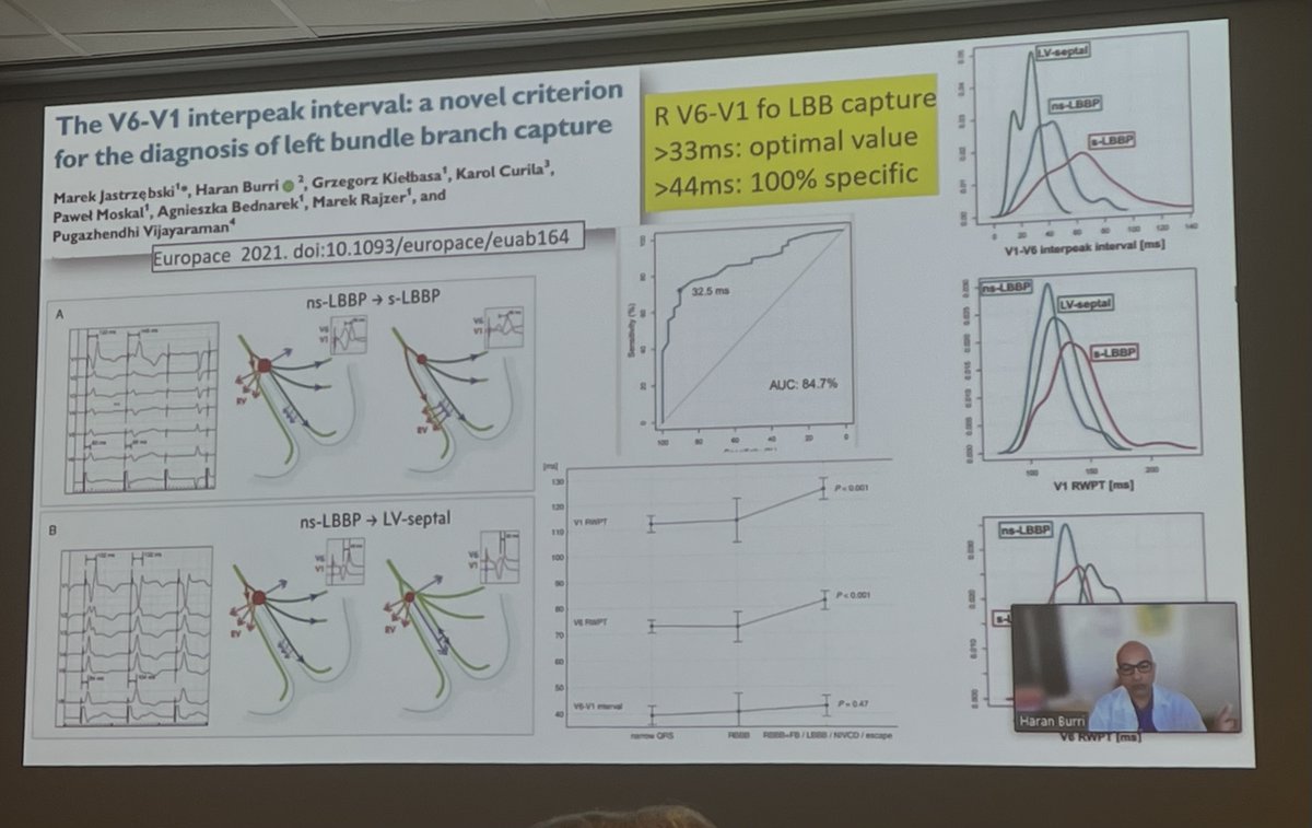 EuropaceEiC's tweet photo. A pleasure to be anchorperson of the #CRT #CSP and physiological pacing module of  #DAS_CAM_2021

Great discussion of a lot of #EUROPACE manuscript presented by @HaranBurri 

@ESC_Journals @escardio @kvernooy @harry_crijns @EHRAPresident @LuigiDiBiaseMD @natale_md @CarolRemme https://t.co/oG4Amipyd0