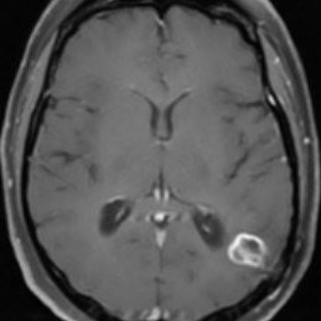 NeuroimagingN's tweet photo. https://t.co/xhUwMzW8SS